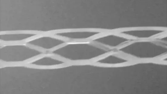 心臟支架高精密激光切割